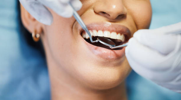 Best Emergency Tooth Extraction in Cape May, NJ